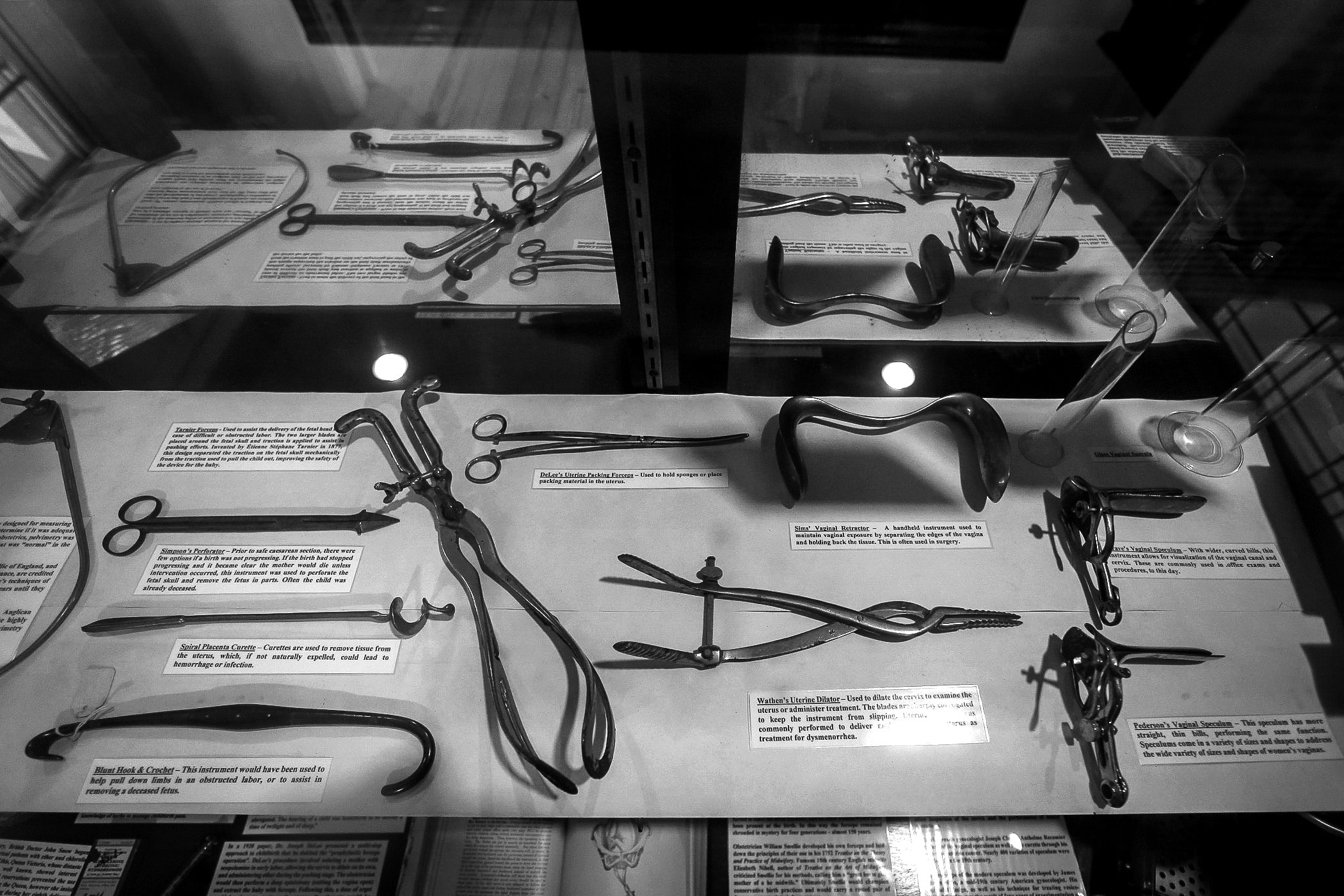 Pregnant women have reported feeling nauseated and experiencing abdominal cramps on the second floor where Dr. Dupas performed experiments on pregnant slave women. (Photo by Michael DeMocker)